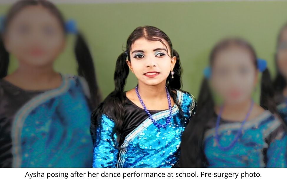 Aysha posing after her dance performance at school. Pre-surgery photo.